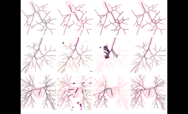 Graph-based biomarker extraction of brain vascular networks